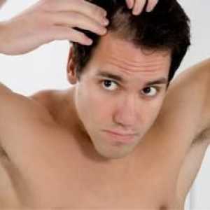 Remedii populare pentru căderea părului: recenzii pentru bărbați și femei